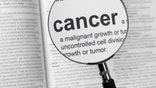 The American Cancer Society - one of the nation's best known and influential health advocacy groups - is  years old this week.
